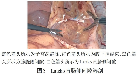 WPS图片(1)3.png