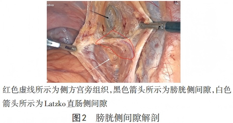 WPS图片(1)2.png